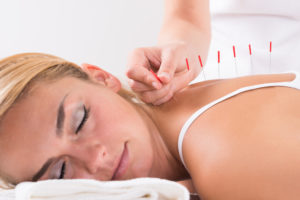 acupuncture wayne nj